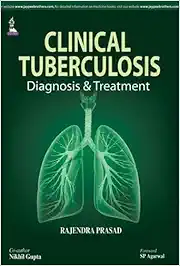 Clinical Tuberculosis: Diagnosis & Treatment: Diagnosis and Treatment (PDF)