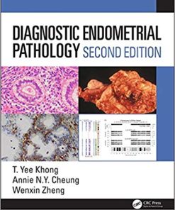 Diagnostic Endometrial Pathology, 2nd Edition (PDF)