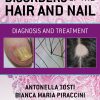 Disorders of the Hair and Nail: Diagnosis and Treatment (PDF)