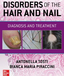 Disorders of the Hair and Nail: Diagnosis and Treatment (PDF)