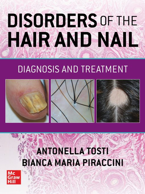 Disorders of the Hair and Nail: Diagnosis and Treatment (PDF)