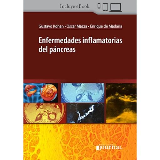 Enfermedades inflamatorias del páncreas (High Quality Image PDF)