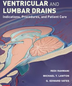 External Ventricular and Lumbar Drains: Indications, Procedures, and Patient Care (PDF)