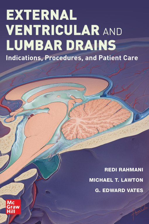 External Ventricular and Lumbar Drains: Indications, Procedures, and Patient Care (PDF)