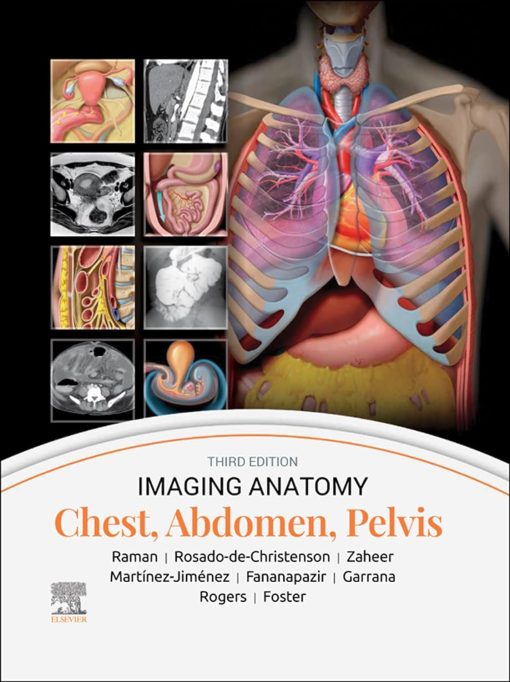 Imaging Anatomy: Chest, Abdomen, Pelvis, 3rd edition (ePub Book)