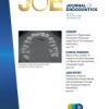 Journal of Endodontics PDF