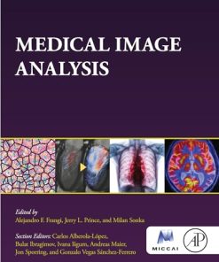 Medical Image Analysis (The MICCAI Society book Series) (PDF)