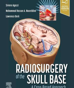 Radiosurgery of the Skull Base: A Case-Based Approach (PDF)