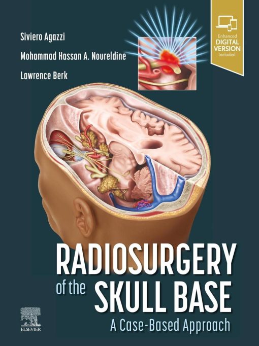 Radiosurgery of the Skull Base: A Case-Based Approach (PDF)