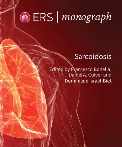 Sarcoidosis (PDF)