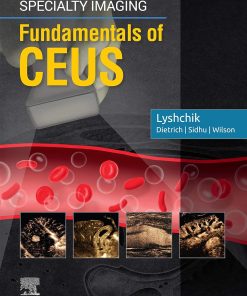 Specialty Imaging: Fundamentals of CEUS (PDF)