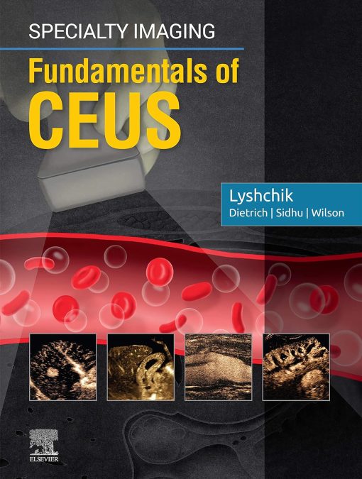 Specialty Imaging: Fundamentals of CEUS (PDF)