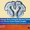 The Human Brain during the Second Trimester 160– to 170–mm Crown-Rump Lengths: Atlas of Human Central Nervous System Development, Volume 9 (PDF)