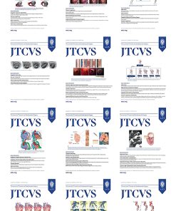 The Journal of Thoracic and Cardiovascular Surgery 2023 Full Archives (PDF)