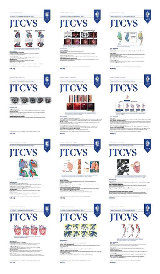 The Journal of Thoracic and Cardiovascular Surgery 2023 Full Archives (PDF)