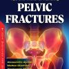 Tips and Tricks for Handling Pelvic Fractures (PDF)