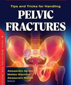 Tips and Tricks for Handling Pelvic Fractures (PDF)