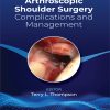 Arthroscopic Shoulder Surgery: Complications and Management (EPUB)