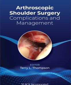 Arthroscopic Shoulder Surgery: Complications and Management (EPUB)