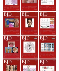 British Journal of Dermatology 2023 Full Archives (PDF)