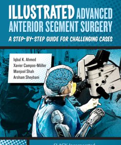 Illustrated Advanced Anterior Segment Surgery