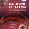 Mastering Iris Repair: A Video Textbook of Iris Repair and Pupilloplasty Techniques (PDF)