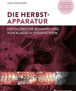 Die Herbst-Apparatur: Erfolgreiche Behandlung von Klasse-II-Dysgnathien (German Edition) (EPUB)