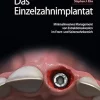 Keramikveneers: 20 Techniken für ästhetischen Erfolg (German Edition) (EPUB)