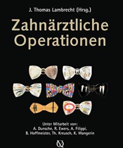 Zahnärztliche Operationen (German Edition) (EPUB)