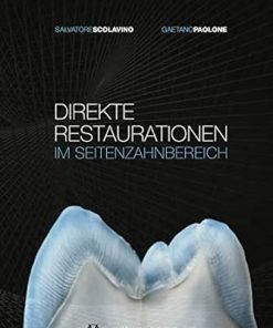 Direkte Restaurationen im Seitenzahnbereich (German Edition) (EPUB)