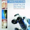 Prep Veneers und Non-Prep Veneers: Keramische minimalinvasive Restaurationen (German Edition) (EPUB)