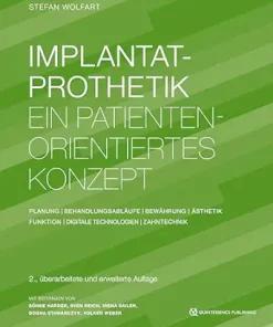 Implantatprothetik: Ein patientenorientiertes Konzept: Planung | Behandlungsabläufe | Bewährung | Ästhetik | Funktion | Digitale Technologien | Zahntechnik, 2nd Edition (German Edition) (EPUB)