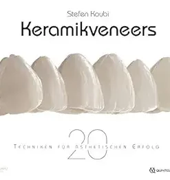 Keramikveneers: 20 Techniken für ästhetischen Erfolg (German Edition) (EPUB)