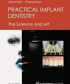 Practical Implant Dentistry: The Science and Art, 2nd Edition (EPUB)