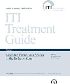 Extended Edentulous Spaces in the Esthetic Zone (ITI Treatment Guide Series Book 6) (EPUB)