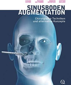 Sinusbodenaugmentation: Chirurgische Techniken und alternative Konzepte (German Edition) (EPUB)