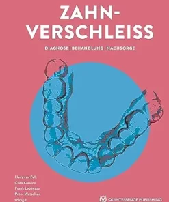 Zahnverschleiß: Diagnose | Behandlung | Nachsorge (German Edition) (EPUB)