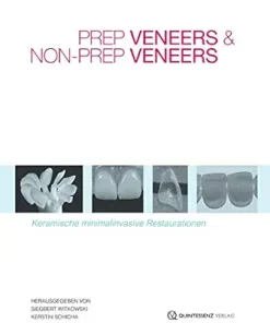 Prep Veneers und Non-Prep Veneers: Keramische minimalinvasive Restaurationen (German Edition) (EPUB)