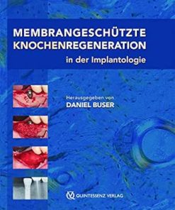 Membrangeschützte Knochenregeneration in der Implantologie (German Edition) (EPUB)