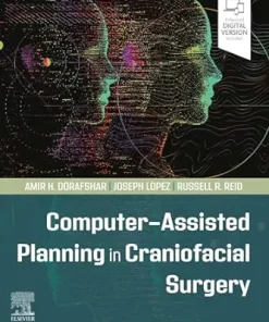 Computer-Assisted Planning in Craniofacial Surgery (ePub+Converted PDF+Videos)