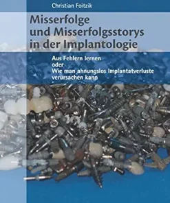 Misserfolge und Misserfolgsstorys in der Implantologie: Aus Fehlern lernen oder Wie man ahnungslos Implantatverluste verursachen kann (German Edition) (EPUB)