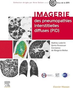 Imagerie des pneumopathies interstitielles diffuses (PID) (French Edition) (PDF)