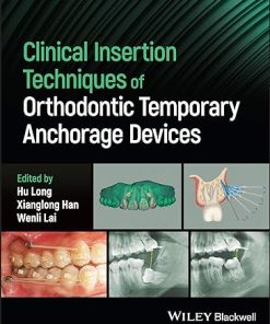 Clinical Insertion Techniques of Orthodontic Temporary Anchorage Devices (PDF)