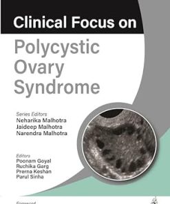 Clinical Focus on Polycystic Ovary Syndrome (EPUB)