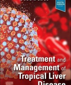 Treatment and Management of Tropical Liver Disease (ePub+Converted PDF)