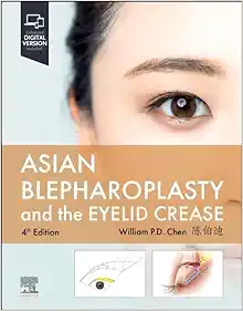 Asian Blepharoplasty and the Eyelid Crease, 4th edition (ePub+Converted PDF)