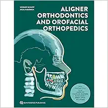 Aligner Orthodontics and Orofacial Orthopedics, 2nd Edition (EPUB)