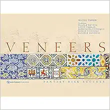 Veneers: Fantasy, Risk, Success (EPUB)