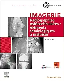 Radiographies ostéoarticulaires : éléments sémiologiques à maitriser (French Edition) (PDF)