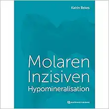 Molaren-Inzisiven-Hypomineralisation (German Edition) (EPUB)